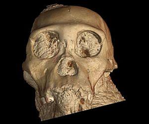 Human brain evolution, new insight through X-rays