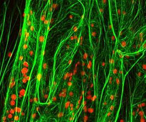 How plants sense gravity - a new look at the roles of genetics and the cytoskeleton