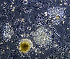 Steps towards the use of adult stem cells for gene therapy