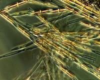 Harmful algal blooms and climate change