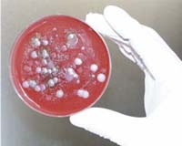 A Cup Of Tea Can Defend Against Anthrax