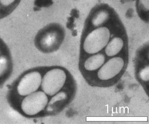 Arsenic-Eating Bacteria Opens New Possibilities For Alien Life