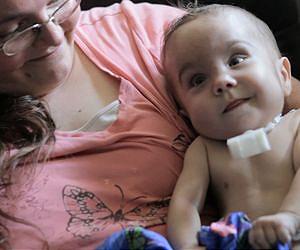 Baby's life saved with groundbreaking 3-D printed device that restored his breathing