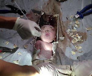 China baby's toilet fall accidental: police