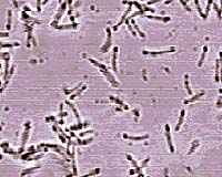 New method of killing bacteria is created