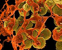 After IS, Mosul tackles another terror: super-resistant bacteria