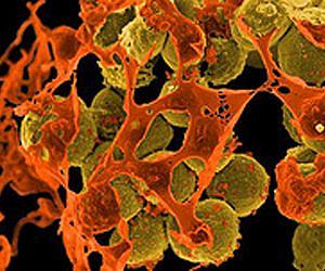 UNC scientists unveil a superbug's secret to antibiotic resistance