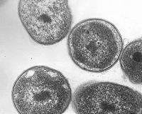 Bacteria the newest tool in detecting environmental damage