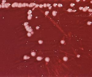 Spacebound Bacteria Inspire Earthbound Remedies