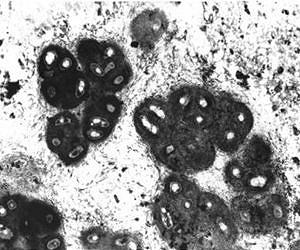 What bacteria don't know can hurt them