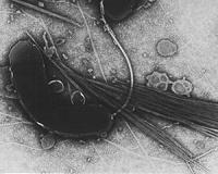 WHO sounds alarm over DRCongo cholera epidemic