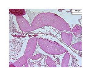 Stem Cell Discovery Could Lead To Improved Bone Marrow Transplants