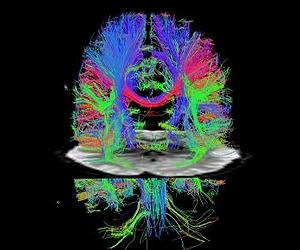 A natural boost for MRI scans