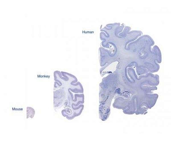 CNES, Pasteur Inst and SupBiotech sending Cerebral Ageing experiment to ISS