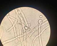 Today's budding yeasts shed traits from their 400-million-year-old ancestor
