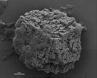 Sea urchin protein provides insights into self-assembly of skeletal structures