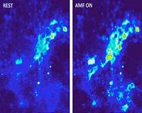 Magnetic brain stimulation