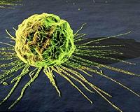 Thyroid cancer 'epidemic' down to overdiagnosis: study