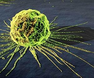 Targeting cancer's sweet tooth