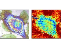 Thermal microscopy of single cells