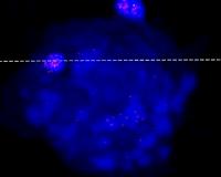 Algae virus can jump to mammalian cells