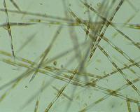 Spread of algal toxin through marine food web broke records in 2015