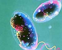 Death toll in Zimbabwe cholera epidemic at 1,732: WHO
