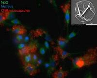 Microcapsules have potential to repair damage caused by osteoarthritis