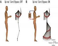 Bypass commands from the brain to legs through a computer