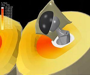 Engineering a better hip implant