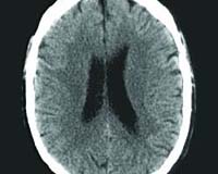 Firms scan brain waves to improve ads in Japan