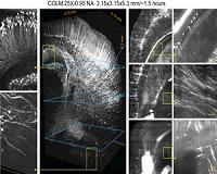 Advanced CLARITY Method Offers Faster, Better Views of Entire Brain