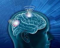 Nonsurgical neural interfaces could expand use of neurotechnology