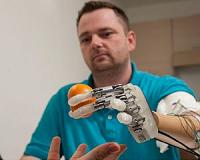 Amputee feels in real-time with bionic hand