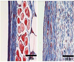 Engineered biomaterial could improve success of medical implants