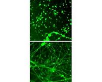 Tamping down neurons' energy use could treat neurodegeneration