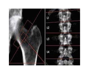Hand-held X-ray source developed