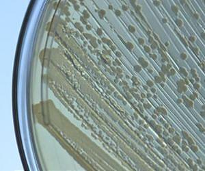 Researchers advance toward engineering 'wildly new genome'