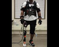 Impact of Power Prosthetic Failures on Amputees