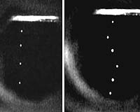 Major Physics Breakthrough In Understanding Supersolidity