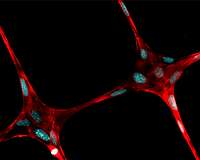 3-D printed microfibers could provide structure for artificially grown body parts