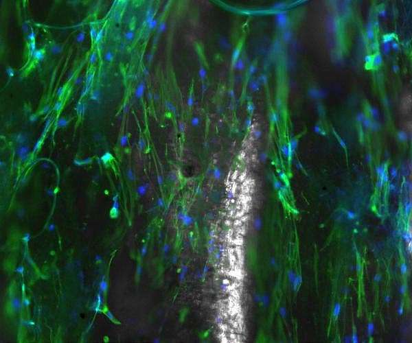 AI Enhances Nanofiber Acoustic Energy Harvesters