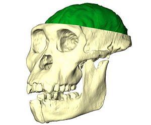 Hominid skull hints at later brain evolution