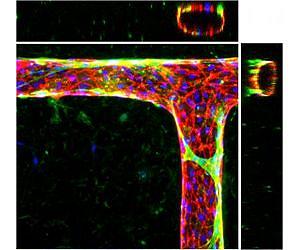 Engineered microvessels provide a 3D test bed for human diseases