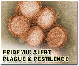 Test allows doctors to see disease without microscope