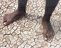 Millions face starvation in EAfrican drought