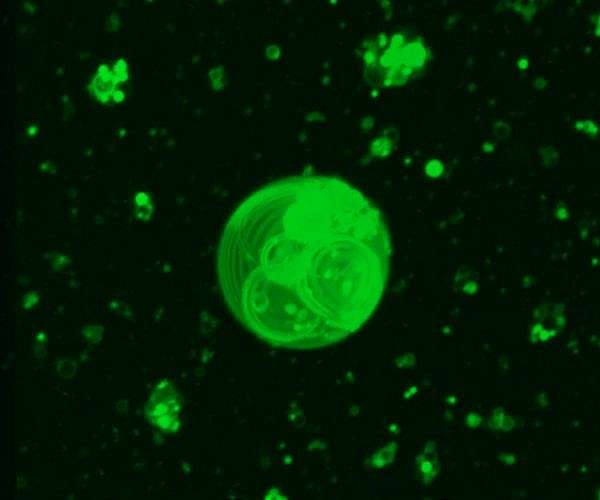 UCLA Team Builds Programmable RNA Organelles Inside Living Cells