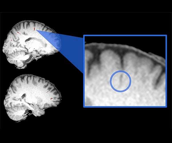 New study reveals the effect of extended space flight on astronauts' brains