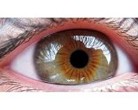 US approves artificial-intelligence device for diabetic eye problems
