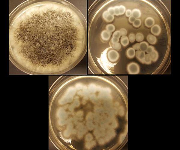 Scientists unveil first-ever 'atlas' describing links between fungi, cancers